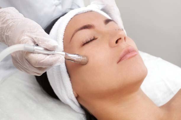 Best Laser Treatment for Acne Scars