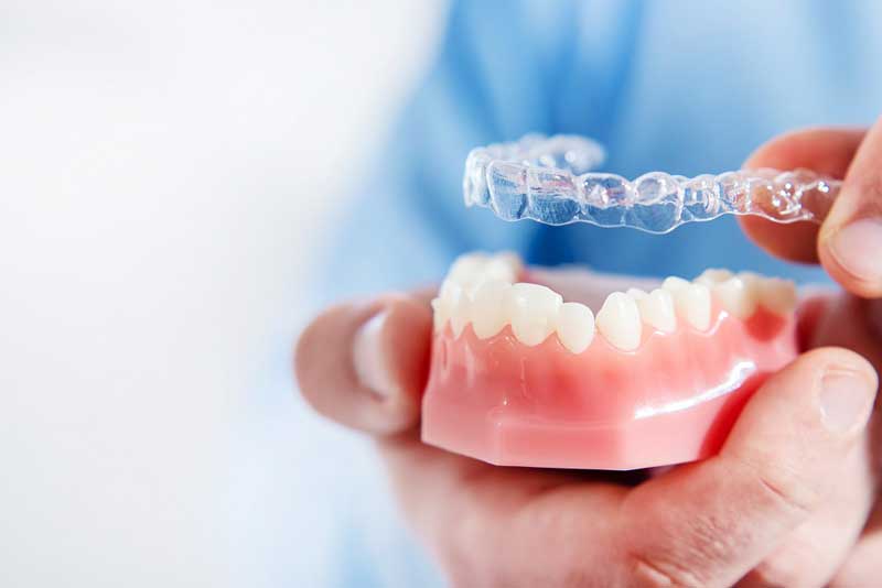 Weighing The Pros and Cons Of Invisalign