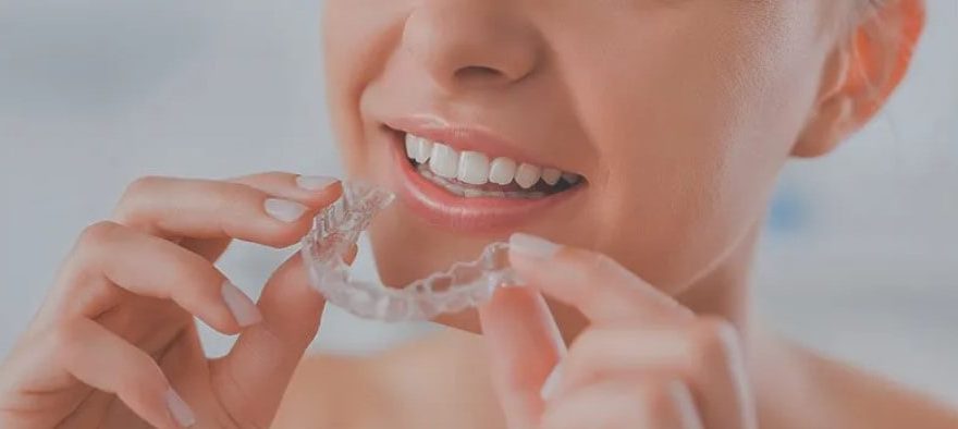 Is Invisalign Teen Right for My Kid